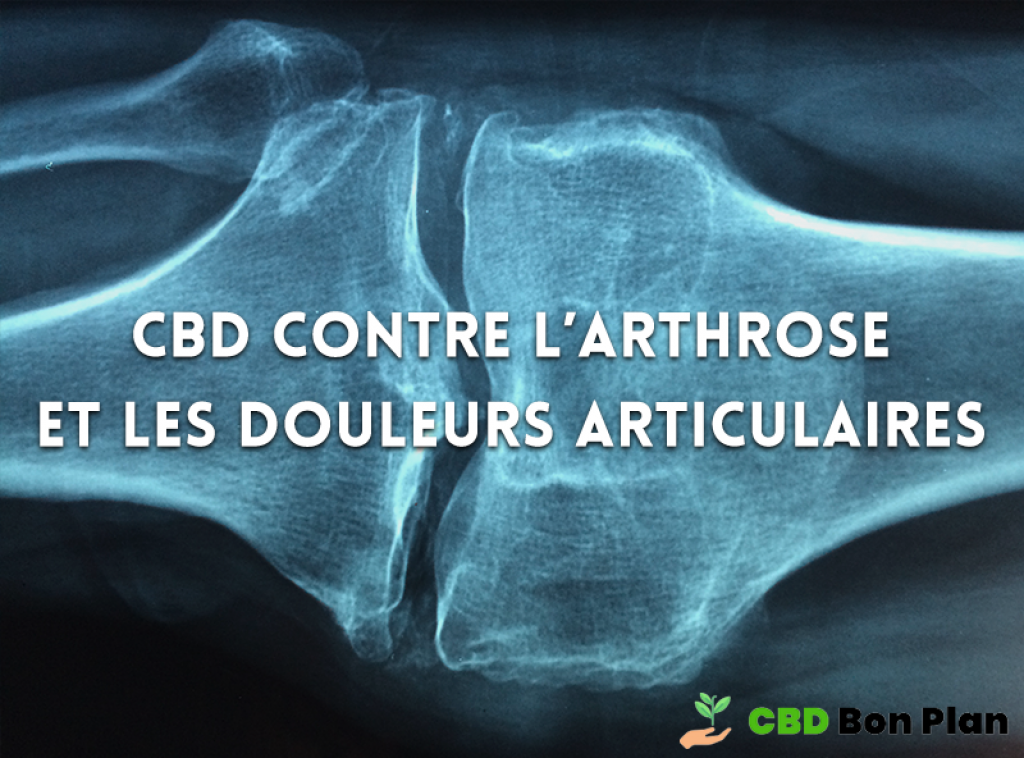 CBD contre l'arthrose et les douleurs articulaires